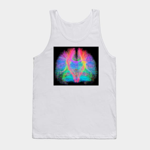 White matter fibres of the human brain (C034/2035) Tank Top by SciencePhoto